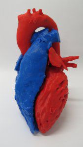 心脏解剖模型 - 3D Lifeprints UK Ltd - 用于心脏手术