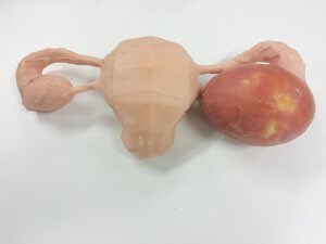 卵巢解剖模型 - 3D Lifeprints UK Ltd - 机器人辅助外科手术 / 用于子宫卵巢切除术