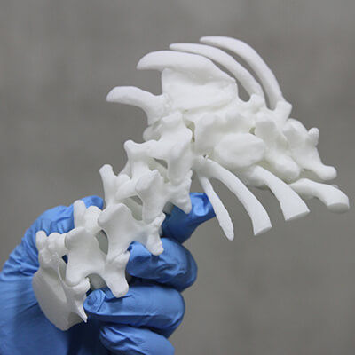 脊柱解剖模型 - 3D Lifeprints UK Ltd - 脊柱侧弯