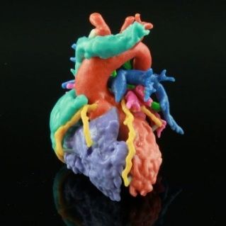 3D打印软件 - HeartPrint - Materialise UK - 医用 / 解剖学 / 规划