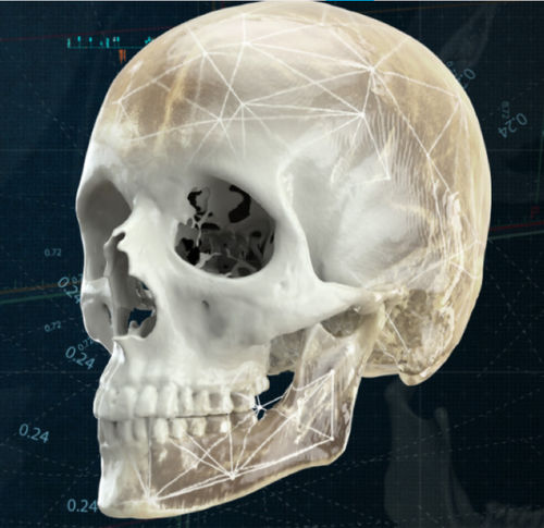 3D可视化软件 - CMF - Materialise UK - 医用 / 用于医院 / 临床