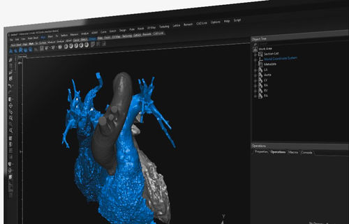 3D可视化软件 - 3-matic  - Materialise UK - 医用 / 解剖学 / 设计