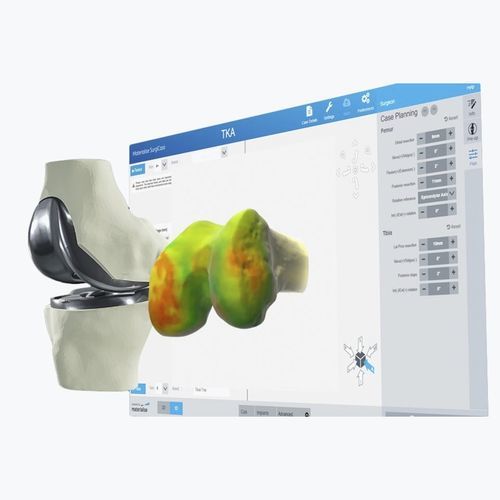 3D可视化软件 - Materialise UK - 规划 / 手术 / 围术期