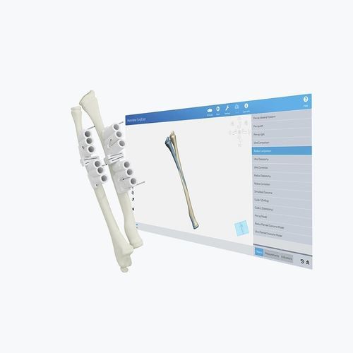 分析软件 - Materialise UK - 术前统筹 / 医用 / 临床