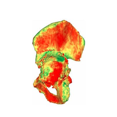 医用软件 - aMace - Materialise UK - 临床 / CT计算机断层扫描 / 手术