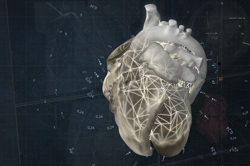 医疗可视化软件 - Materialise UK - 诊断 / 采集 / 规划