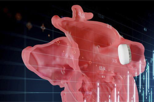 医用软件 - Enlight LAAO - Materialise UK - 解剖学 / CT计算机断层扫描 / 查看