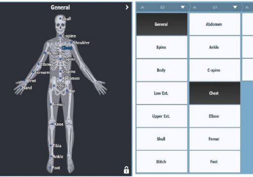 医疗管理软件 - DxWorks - New Medical Imaging - 采集 / 后处理 / 用于放射学