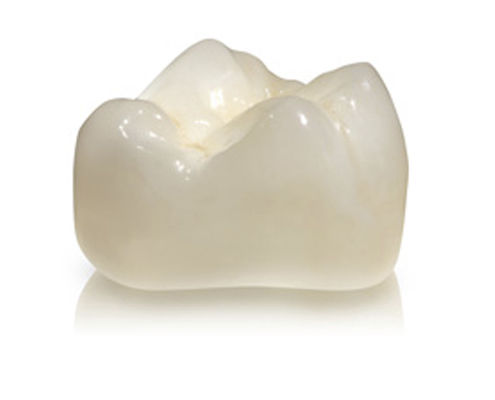 氧化锆牙冠 - DIAMOND - Derby Dental - 后牙 / 半透明