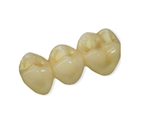 亚克力牙桥 - CAD Temp  - Derby Dental - 后牙 / 后牙