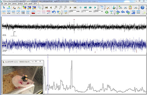 医用软件 - EEG+ - emka TECHNOLOGIES - EMG / 心血管 / 神经系统