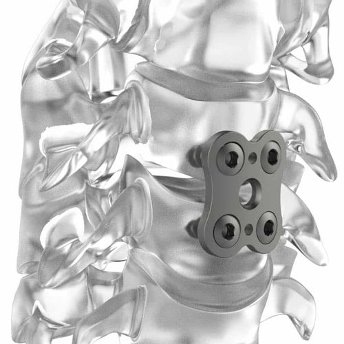 颈椎关节固定板 - PM BUTTERFLY® - NEURO FRANCE Implants - 锁定 / 钛 / 2节
