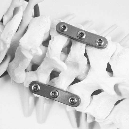 颈椎关节固定板 - STABILAR® PCP - NEURO FRANCE Implants - 未锁定 / 钛