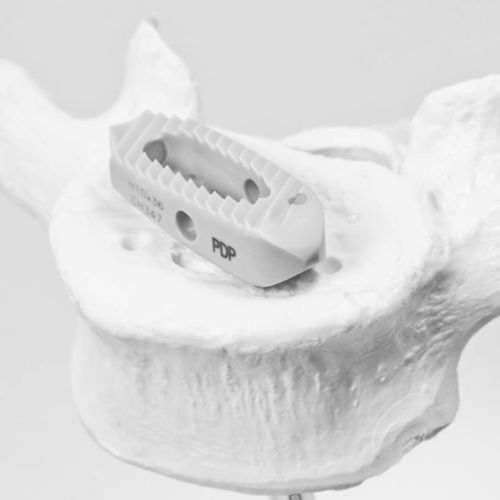 胸腰椎间融合器 - P.D.P - NEURO FRANCE Implants - 后入路 / 椎间孔内 / PEEK材质