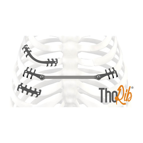 肋骨加压接骨板 - ThoRib® - NEURO FRANCE Implants - 钛 / 儿科