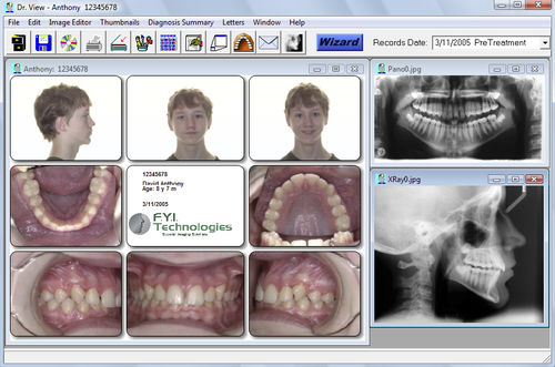 头部测量分析软件 - Dr. View - For Your Imaging Technologies - 正畸
