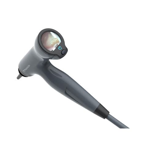 儿科电子耳内窥镜 - Tomiscope - PhotoniCare - OCT成像 / 带视频显示器 / 带诊视器