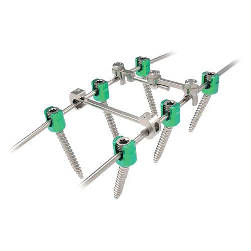 胸腰椎脊柱内固定系统 - Rapidfix  - NORMMED Medical Devices - 后入路
