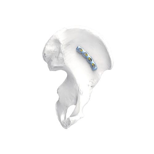 面部肿块加压接骨板 - PNM1075 - NORMMED Medical Devices - 锁定 / 金属