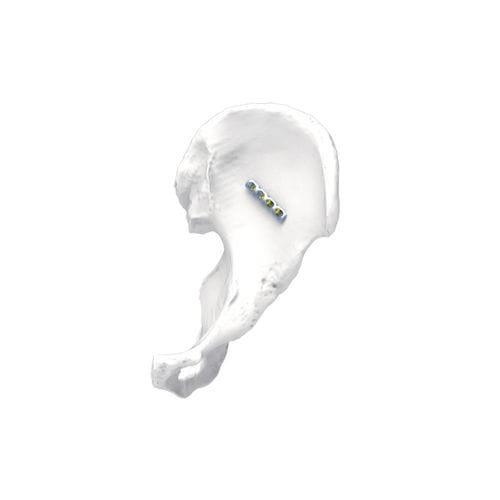 骨盆加压接骨板 - PNM1009 - NORMMED Medical Devices - 锁定 / 金属