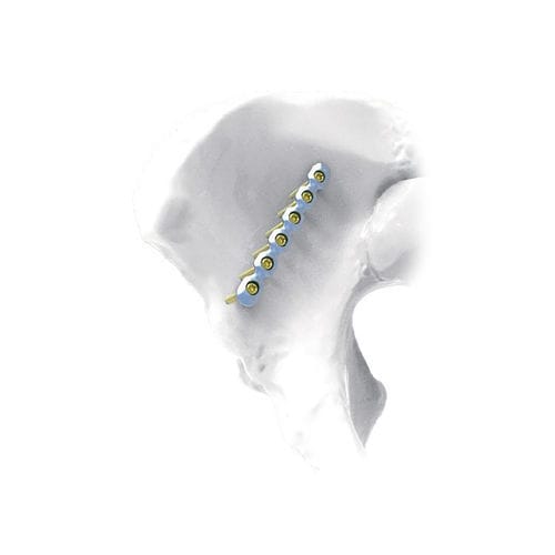 骨盆加压接骨板 - Straight - NORMMED Medical Devices - 锁定 / 金属