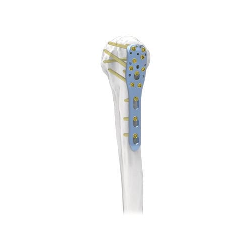 肱骨加压接骨板 - PNM1004 - NORMMED Medical Devices - 近端 / 锁定 / 金属
