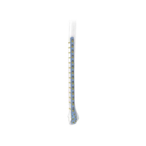 腓骨加压接骨板 - PNM1016 - NORMMED Medical Devices - 远侧 / 侧面 / 锁定