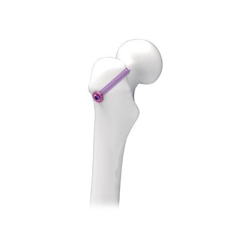 股骨加压接骨螺钉 - NORMMED Medical Devices - 引流管 / 金属
