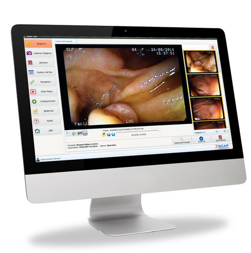 医用软件 - Zscan Plus - Zscan software - 医学成像 / 内窥镜 / 耳鼻喉