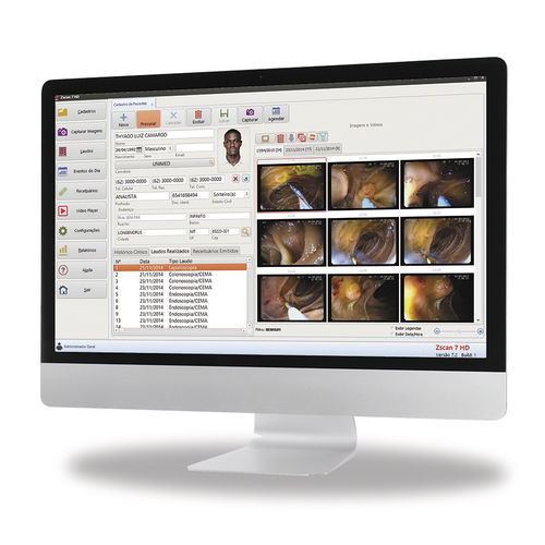 医用软件 - Zscan HD - Zscan software - 医学成像 / 内窥镜 / 耳鼻喉