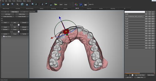 正畸软件 - O3D - Orchestrate Orthodontic Technologies - 控制 / 存档 / 设计