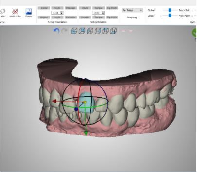 正畸软件 - PLAN - VERSION 5.0 - Orchestrate Orthodontic Technologies - 控制 / 设计 / Windows