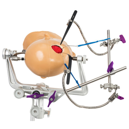 神经外科手术颅骨夹 - TK-6000 - TeDan Surgical Innovations