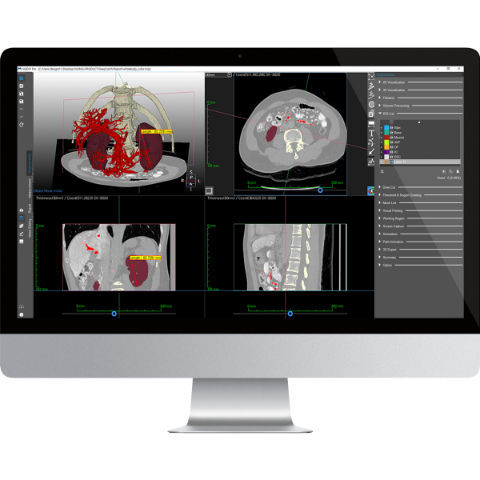 分析软件 - Medip - MEDICALIP Co., Ltd. - 测量 / 3D 打印 / 模型制作