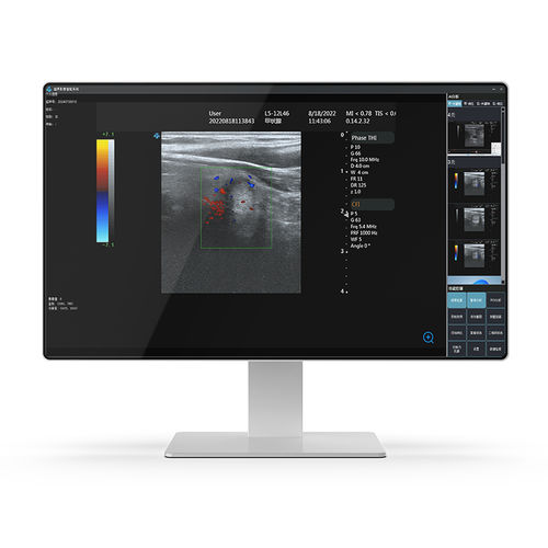 Intel® Core i7医用电脑 - 24H32 - KTC Medical Solutions - 信息设备推车 / 用于医疗机构 / 医疗成像