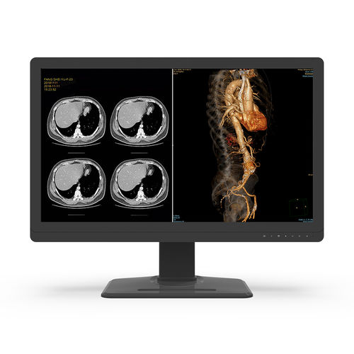 医用显示器 - 32X8C-I1S - KTC Medical Solutions - 诊断 / 用于放射学 / 3840 × 2160