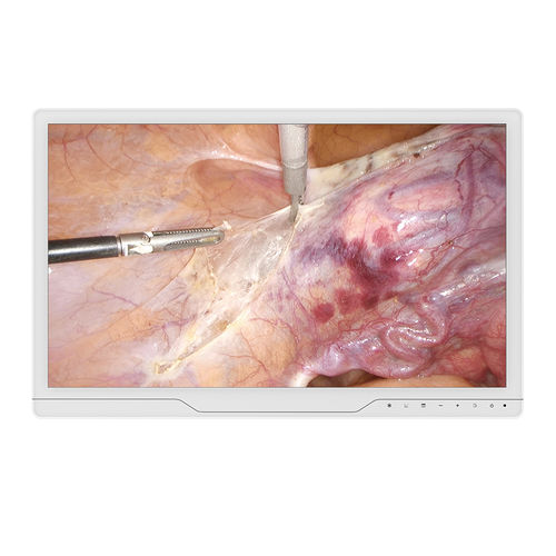 医用显示器 - 22A30 - KTC Medical Solutions - 内窥镜 / 1920 x 1080 / 21.5"