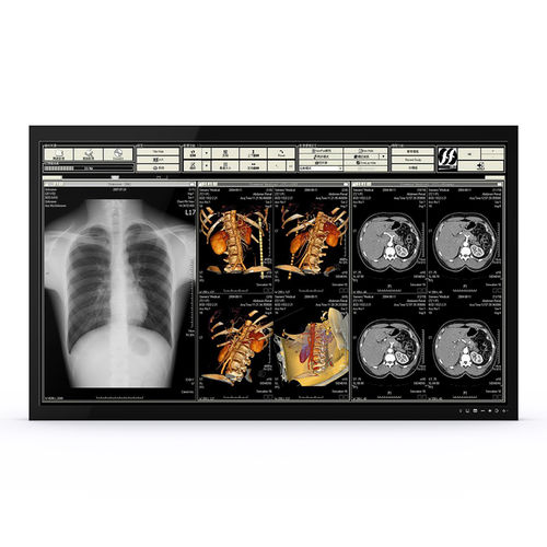 医用监视器 - 65H90 - KTC Medical Solutions - 手术室 / 3840 × 2160 / 65"
