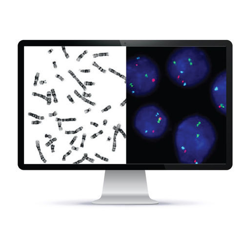 自动化细胞成像系统 - CytoPower™ - Applied Spectral Imaging - 实验室 / 细胞遗传学 / FISH