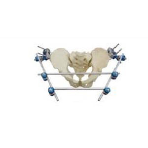 骨盆外固定架 - T8012 - Orthopromed - 管状