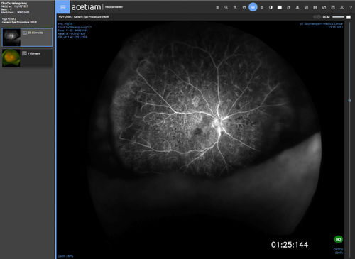 查看软件 - vieviewer Clinic - NEHS DIGITAL - 共享 / 导入 / 医用