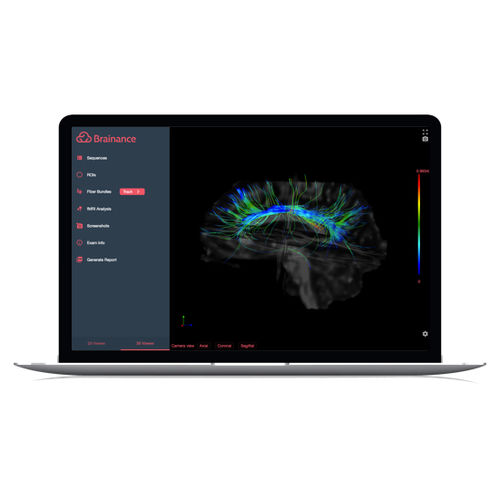 图像分析软件 - Brainance MD  - Advantis Medical Imaging - 报告 / 3D 可视化 / DICOM可视化