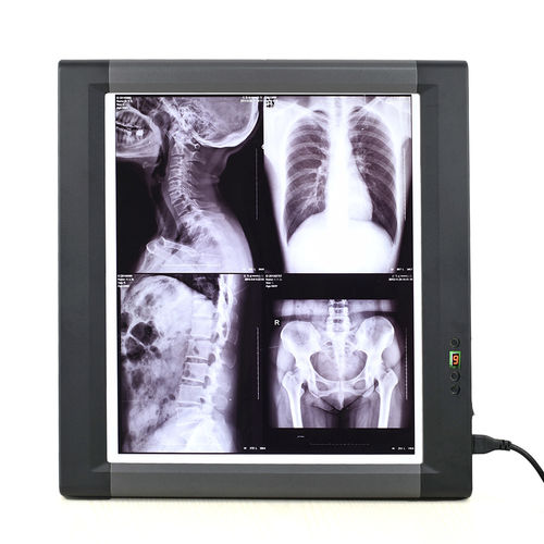 数字X光片观片灯 - MG01 - Nanchang Micare Medical Equipment - 单联式 / 带开关 / LED