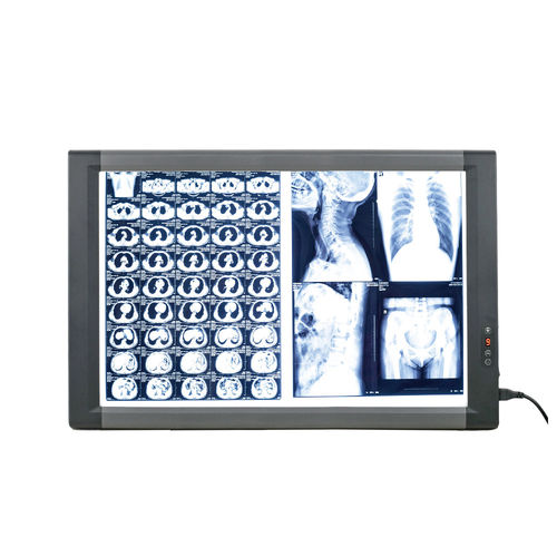 数字X光片观片灯 - MG02 - Nanchang Micare Medical Equipment - 2联 / 带开关 / LED