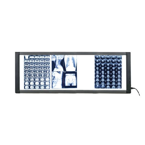 数字X光片观片灯 - MG04 - Nanchang Micare Medical Equipment - 4联 / 带开关 / LED