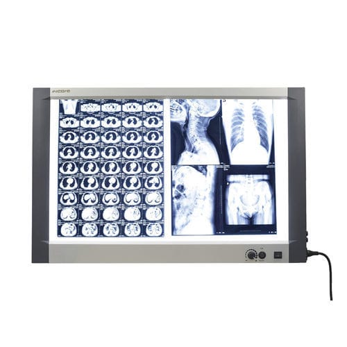 2联X光片观片灯 - MG-02X - Nanchang Micare Medical Equipment - 白光 / 带开关 / 乳腺X射线造影