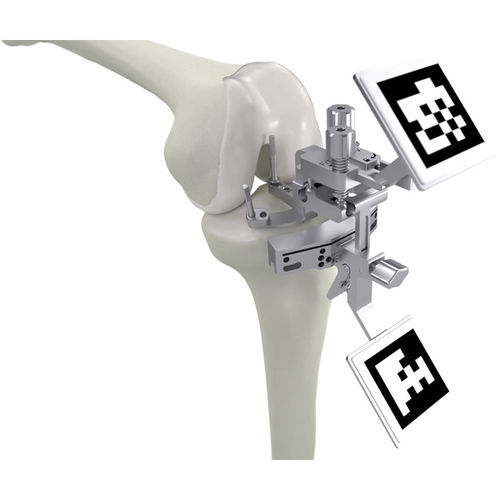 ACL韧带运动分析系统 - PIXEE KNEE + - Gruppo Bioimpianti - 膝关节运动学 / 3D 可视化