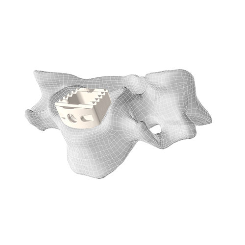 颈椎间融合器 - CL5™ - Corelink Surgical - 前入路 / PEEK材质