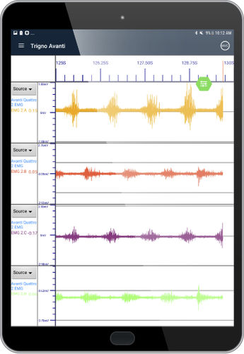 EMG软件模块 - EMG Plots - Delsys - 可视化 / 治疗计划制定 / 培训