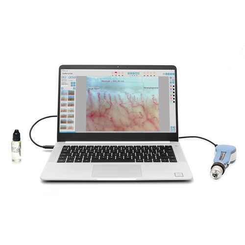 视频毛细血管镜 - DM-120 CapiScope series - Inspectis - 电脑